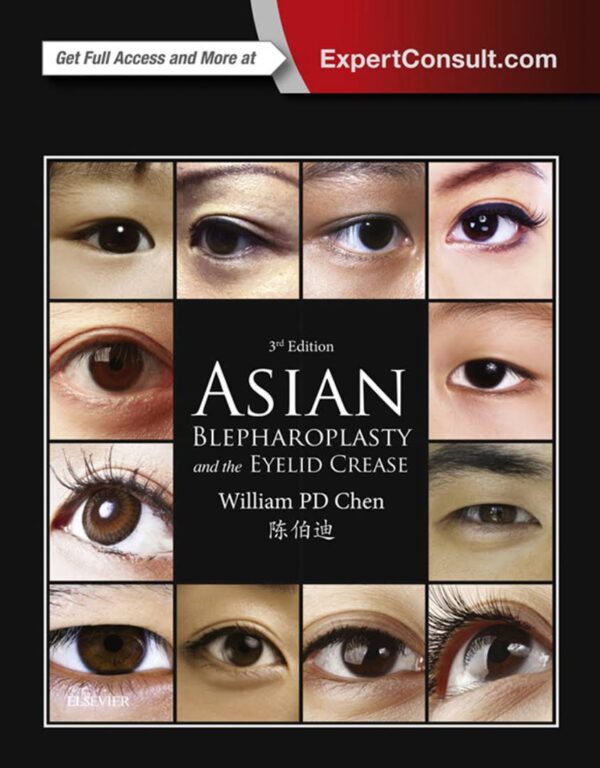 Asian Blepharoplasty And The Eyelid Crease 3Rd Edition (Pdf+Videos) - Medical Course Shop | Board Review Courses