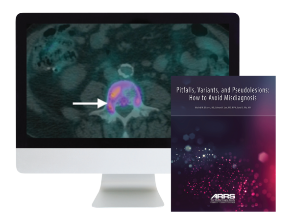 Arrs Pitfalls, Variants, And Pseudolesions: How To Avoid Misdiagnosis 2019 - Medical Course Shop | Board Review Courses