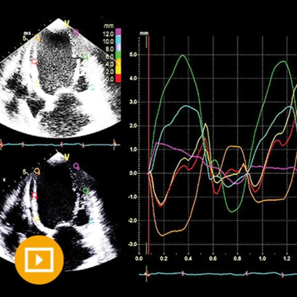 Oakstone Echocardiography A Comprehensive Review 2022 - Medical Course Shop | Board Review Courses