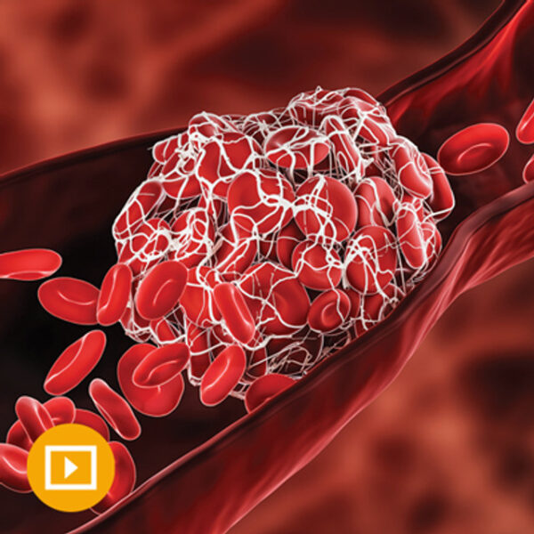 Thrombosis &Amp;Amp; Thromboembolism 2022 ( Videos) - Medical Course Shop | Board Review Courses