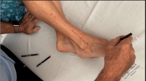 Lyftogt Perineural Injection Treatment: How to Treat Peripheral Nerve Pain 2024 - Medical Course Shop | Board Review Courses