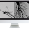 ARRS Case Review of Vascular and Interventional Radiology 2023