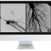 ARRS Case Review of Vascular and Interventional Radiology 2023