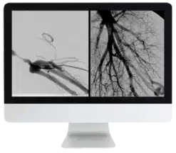 ARRS Case Review of Vascular and Interventional Radiology 2023