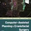 Computer-Assisted Planning In Craniofacial Surgery (EPub + Converted PDF + Videos)