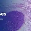 MSKCC The Pathology of Neoplastic Diseases 2025 (Videos with subtitles + Slides)